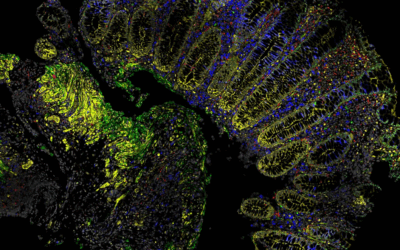Exploring the world of bioimaging analysis: A new graduate-level course offering
