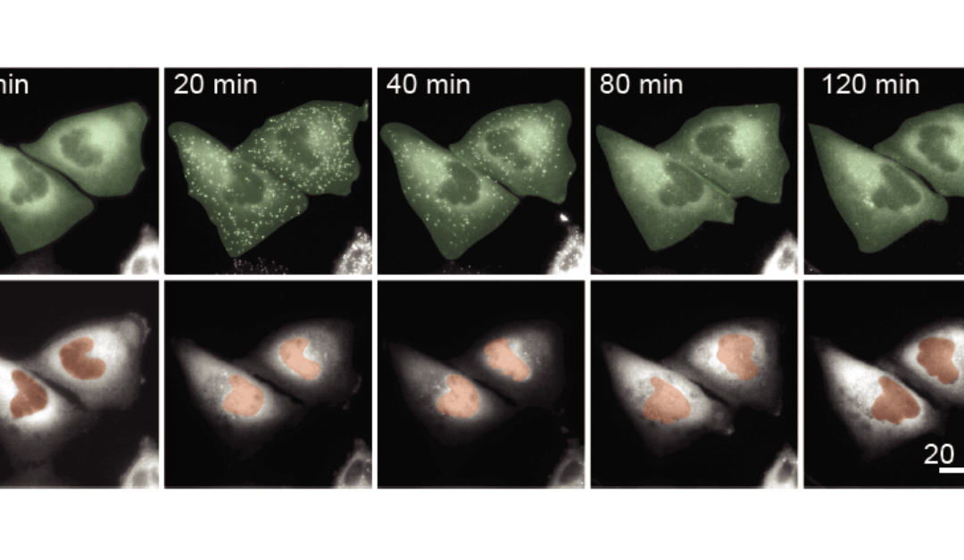 Pitt researchers uncover how timing of cellular signals shape life-or-death decisions