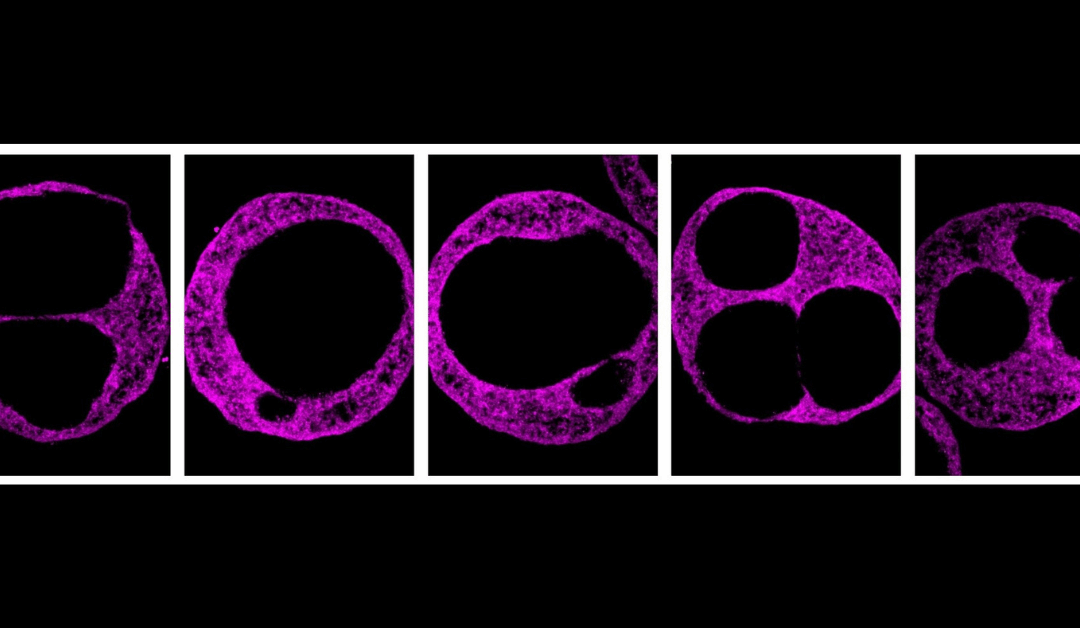 Study reveals role of hyaluronic acid in human heart development
