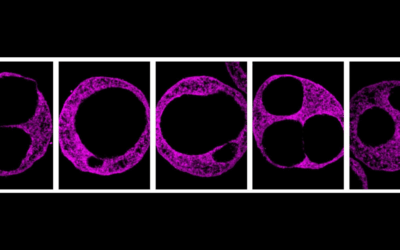 Study reveals role of hyaluronic acid in human heart development